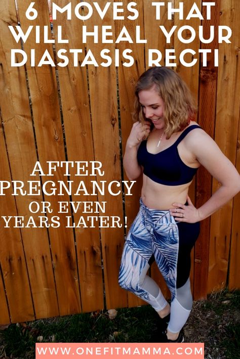 Standing Diastasis Recti Exercises, Diastasis Recti Yoga, Ab Workouts At Home Diastasis Recti, Fix Diastasis Recti 21 Days, Diastasis Recti Before After, Yoga For Diastasis Recti, How To Heal Diastasis Recti, Heal Diastasis Recti, Exercise To Heal Diastasis Recti