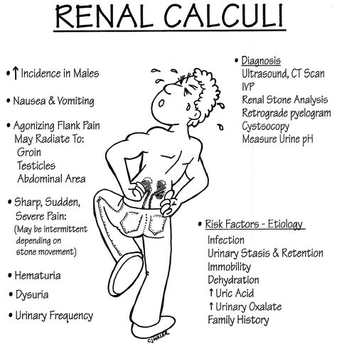 Renal Calculi, Anatomy, Nursing