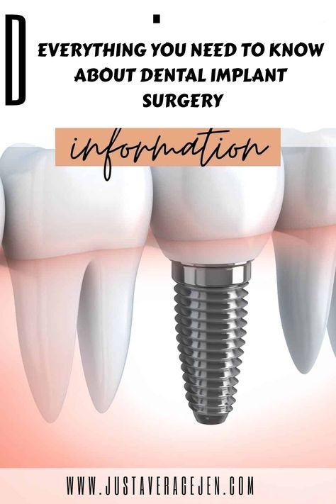 Everything you need to know about dental implant surgery and the options you have for it so it can benefit you in the long term Tooth Bridge, Dental Implant Procedure, Dental Implant Surgery, Pinterest Tutorials, Teeth Implants, Bone Loss, Dental Implant, Natural Teeth, Dentures