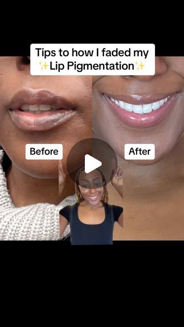 Sarah - Unlock the glow, join the skincare flow! ✨ on Instagram: "Can you guess how this happened to me? ⬇️😭  Answer: Reacted after an expired product I used on my lips but I learnt so much from this experience and thought I’d share it!   Tips to how I faded the pigmentation ⬇️  ✨Keep your lips hydrated at all times with Vaseline  ✨Say no to those lip scrubs  ✨DIY will make your pigmentation worse  ✨Have patience to allow your lips to heal ✨Applied SPF lip balm in mornings always  ✨Stopped using all lip products temporarily  ✨After healing, I started to use 2 products that helped fade my lip pigmentation   Join me on my skincare journey for more tips!   #lippy #lipscrub #skincare #skin #lipcare" Lighten Lips Naturally Fast, How To Remove Lip Pigmentation, How To Get Rid Of Dark Lips, How To Apply Lip Gloss, Lip Pigmentation Remedy, Lip Products Aesthetic, Lighten Lips, Lip Hyperpigmentation, Pigmentation Remedy