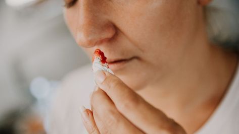 While it may be disturbing to see blood drip from your otherwise placid nose, nosebleeds are typically harmless annoyances. Learn about the home remedies you can use to stop the flow of a bloody nose. Stop Nose Bleeds, Blood Drip, Nose Bleeds, Headache Types, Types Of Surgery, Headache Prevention, Cerebrospinal Fluid, Brain Surgery, Light Sensitivity