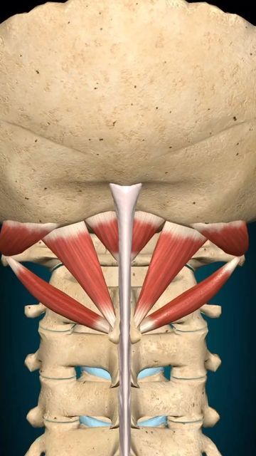 Bradley Blair Osteopath on Instagram: "The suboccipital muscles are a group of four muscles situated underneath the occipital bone. All the muscles in this group are innervated by the suboccipital nerve. They are located within the suboccipital compartment of the neck; deep to the sternocleidomastoid, trapezius, splenius and semispinalis muscles. They collectively act to extend and rotate the head. The rectus capitis posterior minor is the most medial of the suboccipital muscles. There is a c Suboccipital Muscles, Anatomy Movement, Neck Muscle Anatomy, Occipital Bone, Neck Pain Exercises, Occipital Neuralgia, Muscle Movement, Group Of Four, Muscle Relief