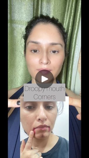 298K views · 2.5K reactions | Droopy mouth corners / mouth corners /mouth aging #faceexercise #facecare #droopymouth | Face._sculpting | Face._sculpting · Original audio Sculpting Face, Facial Fitness, Face Sculpting, Face Yoga Facial Exercises, Face Time, Face Lifting, Face Exercises, Sciatica Pain, Yoga Facial