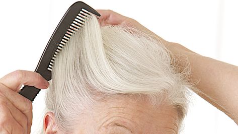 Do you have hearing aids, bald patches, drooping ear lobes or scars that are difficult to cover up as your hair thins and changes with age? Here's some hairstyles that will hide and made you feel confident again. Hairstyles To Hide Bald Spots, Hairstyle To Cover Ears, How To Hide Bald Spots Women, How To Cover Bald Spots Women, Hairstyle To Cover Bald Spot, Hair Thinning At Crown, Bald Spots Women, Hair Toppers For Frontal Fibrosing Alopecia, Some Hairstyles