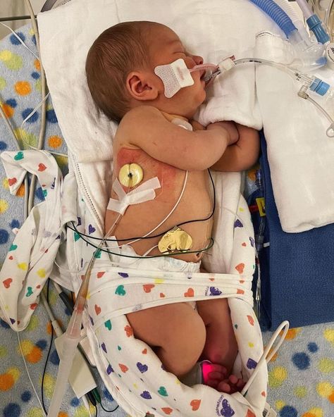 BRINGING Up Bates’ Zachary and Whitney Bates revealed that their newborn son Jadon is on a ventilator after his “right lung collapsed.” Zach, 32, and Whitney, 27, described how their infant had a “rough night” in an Instagram post.  The couple wrote: “His oxygen levels continued dropping, and his right lung collapsed. They intubated and put […] Whitney Bates, Rough Night, Words Of Support, Bates Family, Bring Up, Childrens Hospital, Feelings And Emotions, Baby Photos, Little One