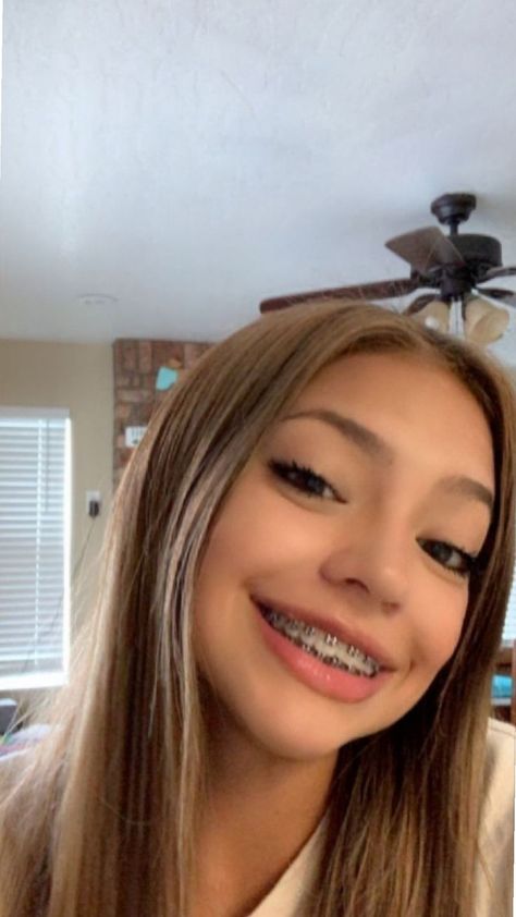 Blonde With Braces, Pretty Girls With Braces Blonde Hair, Pretty Mexican Girls With Braces, Braces Aesthetic Girl, Latina With Braces, Braces Selfie, Baddies With Braces, Pretty Braces, People With Braces