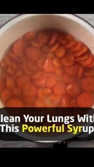 pure health on Instagram: "Home Remedy for Clearing lungs using carrots, honey and lemons.

Advocated by Prof Chen Hui Ren from the Beijing Army General Hospital.

#lunghealth #lungesworkout #healthylifestyle #healthyliving #healthtips #naturalremedy #immunesupport #AntiInflammatory #fightanexity #StressReliefTips #stressrelief #acidrefluxrelief #hurtburnrelief #EnergyBoost 
#FoodAsMedicine" Lung Health Remedies, Medicinal Remedies, Clean Lungs, Honey Health Benefits, Clear Lungs, Burn Relief, Acid Reflux Relief, Low Back Pain Relief, Healthy Juicer Recipes