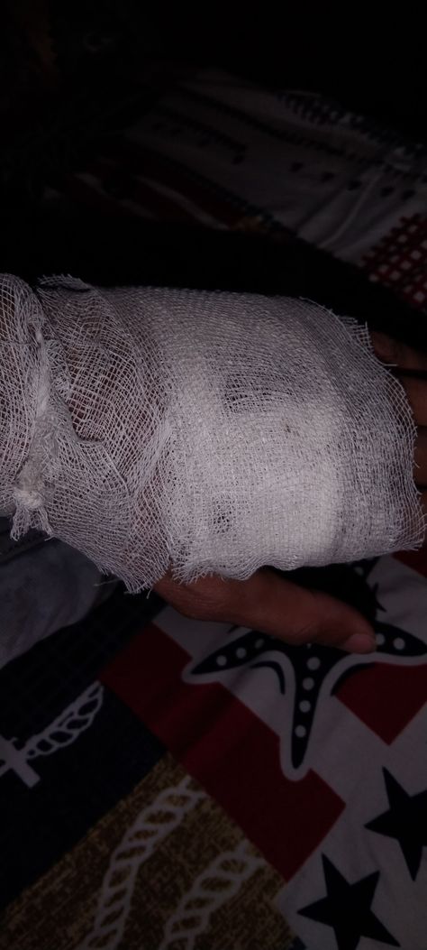 Accident Boys Dpz Hospital, Hat Kata Pic Real, Hand Damage Dpz, Hand Kata Pic Real, Injury Snapchat Streaks, Accident Hand Dpz, Accident Dp, Heart Overlay, Gals Photos