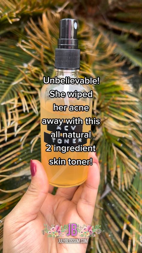 Apple Cider Face Toner, How To Use Apple Cider Vinegar For Skin, Acv Face Toner Diy, Apple Cider Vinegar Toner Recipe, Apple Cider Vinegar Skin Care, Diy Face Toner For Acne, Apple Cider Vinegar Face Wash Recipe, Acv Toner Diy, Apple Cider Vinegar Rinse For Hair