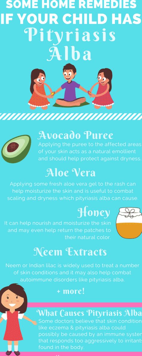 Pityriasis Alba, Home Remedies For Spiders, Fresh Aloe Vera Gel, Fresh Aloe Vera, Healthy Lunches For Kids, Cold Home Remedies, Holistic Remedies, Skin Remedies, Natural Health Remedies