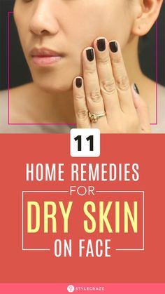 Dry Face Remedy, Flaky Skin On Face, Dry Skin Remedies For Face, Dry Skin Home Remedies, Get Rid Of Dry Skin, Dry Skin Diy, Dry Skin Face, Skin Home Remedies, Natural Remedies For Cold