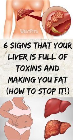 Non Alcoholic Fatty Liver Strategy is the ultimate program for detoxifying and repairing your liver in four weeks to eliminate non alcoholic fatty liver and the risks that come with it. Autogenic Training, Natural Liver Detox, Liver Detox Diet, Cleanse Your Liver, Detox Your Liver, Full Body Detox, Detox Diet Plan, Liver Diet, Healthy Liver