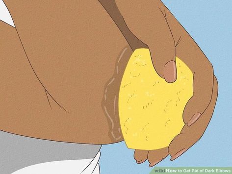 How to Get Rid of Dark Elbows: 8 Steps (with Pictures) - wikiHow Rough Elbows, Dry Elbows, Dark Elbows, Dark Underarms, Black Neck, Remove Dark Spots, Aloe Leaf, Some Body, Skin Remedies