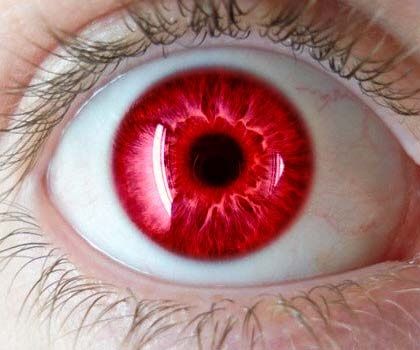 bloodshot eyes Iris Eye, Rare Eyes, Eyes Artwork, Aleister Crowley, Eye Pictures, Red Eye, Aesthetic Eyes, Human Eye, Eye Art