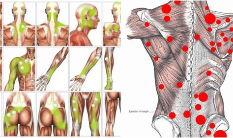 Trigger Points Neck, Myofascial Release Massage, Punkty Spustowe, Exercises For Back Pain, Exercises For Back, Trigger Point Release, Myofascial Pain Syndrome, Trigger Point Massage, Musculoskeletal Pain