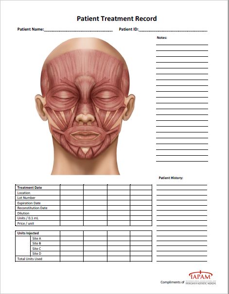 Facial Mapping, Botox Eyes, Esthetician Resume, Botox Injection Sites, Botox Training, Neuromuscular Junction, Botox Injection, Forehead Lines, Facial Anatomy