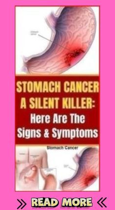 Silent Killer, Healthy Facts, Womens Health Care, Stomach Ulcers, Health Signs, Women Health Care, Diets For Women, Daily Health Tips, Natural Health Tips