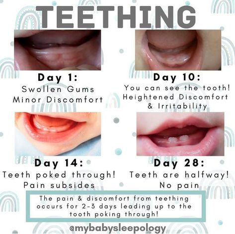 MyBaby Sleepology on Instagram: "Teething 🦷 & Sleep 💤  ☑️ Fact: Teething can be responsible for a few tough nights... not 15-20!  If teething is always being blamed.. reach out for help 😉  Swipe to the right 👉🏻 and let us know which stage your little one is at with their teething!😂👇🏼  👯‍♀️Tag a mama who might find this info helpful!" Teething Stages Baby, Teething Hacks, Pregnancy Prayer, Teething Stages, Belly Casting, Baby Routine, Pregnancy Info, Teething Baby, Newborn Baby Tips