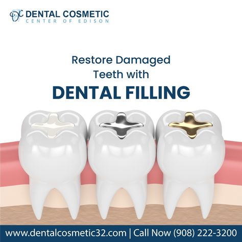 Are you looking for a way to restore your teeth to their natural beauty? Look no further than DENTAL FILLING! Our revolutionary dental cosmetic solution is designed to fill in cavities and repair damage, giving you the perfect smile. visit us at www.dentalcosmetic32.com Book an appointment (908) 222-3200 #dentalcosmetic #edison #dentalcare #smile #Plainfield #naturalbeauty #dentalcare Filling Teeth, Teeth Filling, Dental Post, Dental Advertising, Tooth Filling, Dental Decay, Dental Posts, Dental Restoration, Dental Fillings