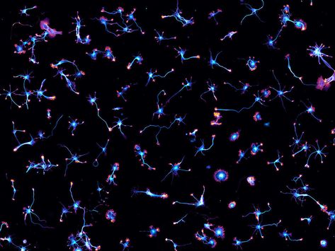 <em>Starry Night</em>, Staff Pick 2017. This image shows hippocampal neurons after two days in culture. Brain Neurons, Newspaper Design Layout, Vision Of Love, University College London, Bio Art, Iconic Album Covers, Newspaper Design, Art And Science, Digital Painting Tutorials