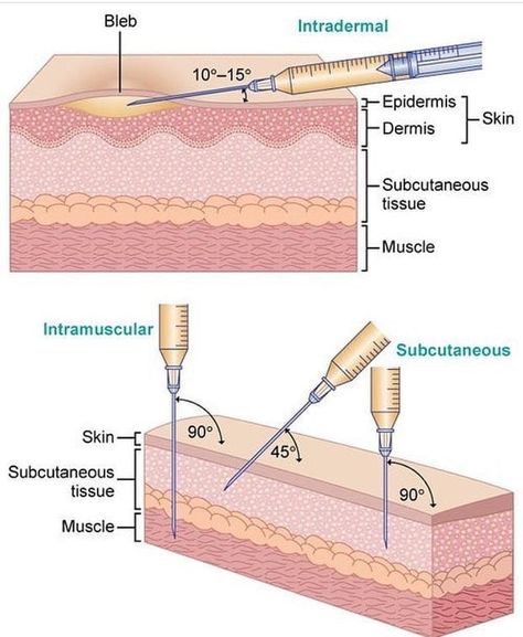 Med_students0 on Instagram: “Different types of injections” Certified Medical Assistant, Fundamentals Of Nursing, Nursing School Studying, Nursing School Tips, Nursing School Notes, Phlebotomy, Medical Terminology, Nursing Tips, Nursing Career