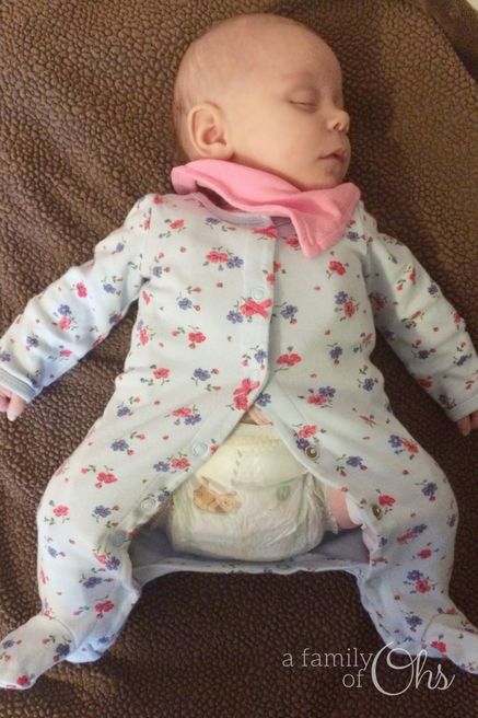 Tips for the Pavlik Harness - a family of Ohs Hip Dysplasia Baby, Hippy Baby, Pavlik Harness, Leather Garter Belt, Thigh Harness, Leather Garter, Baby Help, Leg Harness, Hippie Baby