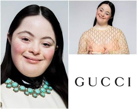 This is Ellie Goldstein, who has become the new Gucci model. First one with down syndrome.

Respect to the brand for tolerance and treating every human being equal. This is also an act of love, showing beauty in every person. ❤ Subway Baby, Show Beauty, Gucci Model, Influential People, Skin Care Remedies, Gucci Models, Human Being, Human Anatomy, Father And Son