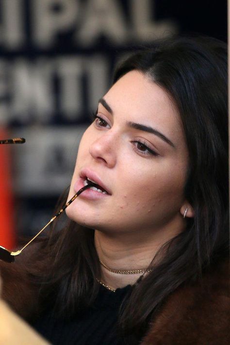 Kendall Jenner : 4 conseils de sa dermato pour se débarasser de l'acné Acne Is Normal, Acne Positivity, Skin Positivity, Kendall Jenner Icons, Kendall Jenner Face, Style Kendall Jenner, Kendall Jenner Photos, Kendall Kylie Jenner, Real Skin