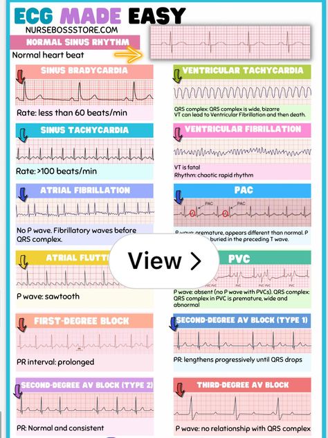 Lemon8 · EKG cheat sheets · @Hailey Learn Ekg Cheat Sheets, Telemetry Nursing Cheat Sheets, Cardio Nursing Cheat Sheets, Ekg Reading Cheat Sheets, Ekg Cheat Sheet, Ekg Interpretation Cheat Sheet, Acls Rhythms Cheat Sheets, Easy Ekg Interpretation Cheat Sheets, Ekg Rhythms Cheat Sheets