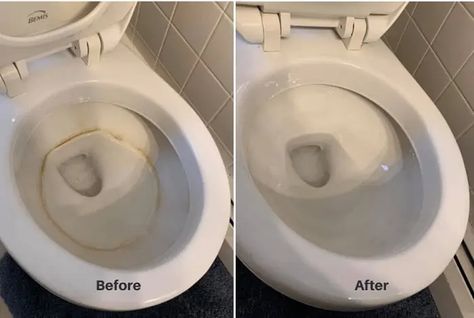 How To Clean Toilet Bowl Ring Clean Toilet Ring, Clean Toilet Bowl Ring, Cleaning Toilet Ring, Toilet Ring Remover, Clean Toilet Bowl Stains, Toilet Bowl Stain, Toilet Bowl Ring, Ring Cleaner, Toilet Bowl Stains