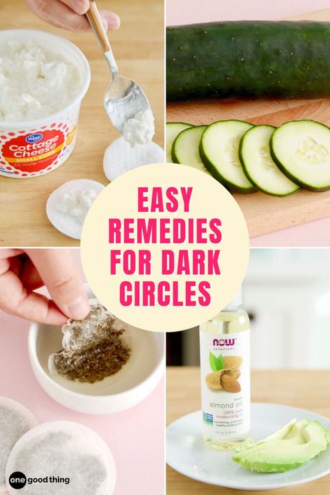 Remove under eye dark circles with ease! These are 13 simple ways to treat your under eye bags and dark circles, with whatever you have at home. How To Get Rid Of Dark Circles Under The Eyes, Dark Bags Under Eyes, How To Reduce Dark Circles Under Eyes, Diy Dark Circles Under Eyes, Get Rid Of Dark Circles Under Eyes, Bags Under Eyes Remedy, How To Get Rid Of Dark Circles Under Eye, Dark Under Eye Circles, Under Eye Dark Circles