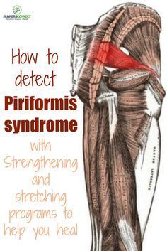 Running Injury Prevention, Psoas Release, Stretching Program, Piriformis Muscle, Piriformis Stretch, Piriformis Syndrome, Psoas Muscle, Sciatic Nerve Pain, Sciatica Pain