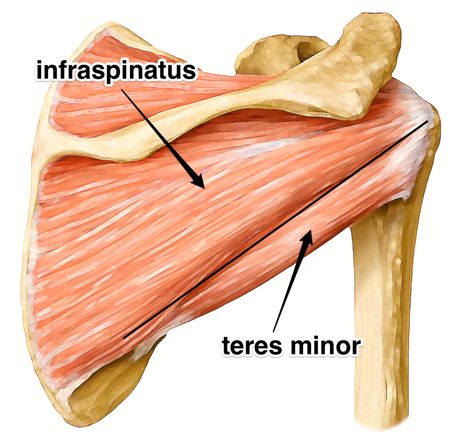 Infraspinatus:  Learn Your Muscles  This is one of the four rotator cuff muscles. Continue reading to learn how to keep it healthy. Supraspinatus Muscle, Infraspinatus Muscle, Rotator Cuff Muscles, Pectoralis Major, Rotator Cuff Surgery, Rotator Cuff Tear, Rotator Cuff Injury, Pilates Benefits, Muscle Anatomy