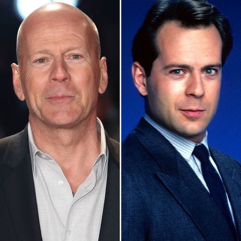 Bruce Willis, Jason Statham, and More Bald Celebrities Who Look Way Different With Hair Jason Statham Hair, Jason Statham Beekeeper, Jason Statham With Hair, Jason Statham Funny, The Mechanic Jason Statham, Transporter Jason Statham Movies, Going Bald, Colin Firth, Jason Statham