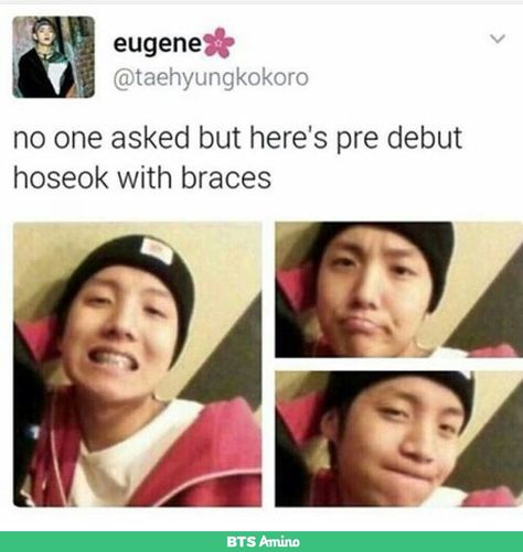 How does he look so good with braces? How?! Bts Tweet, Hoseok Bts, First Love Bts, The Perfect Guy, About Bts, I Love Bts, Bts J Hope, All Music, Bts Book