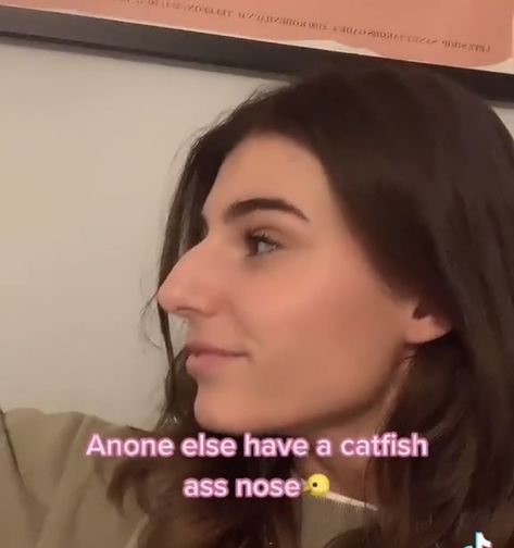 Small Hooked Nose, Jewish Nose Women, Ugly Noses, Nose Bleeds Aesthetic, Big Nose Women, Greek Nose, Dupuytren's Contracture, Pointy Nose, Body Neutrality