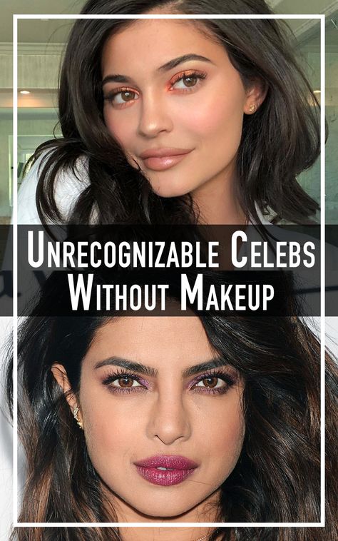 Celebrities Covering One Eye, Celebrity Without Makeup, Actresses Without Makeup, Celebrities Without Makeup, Celebs Without Makeup, Diy Fireplace Makeover, Celebrity Costumes, Prettiest Celebrities, Tuscan Design