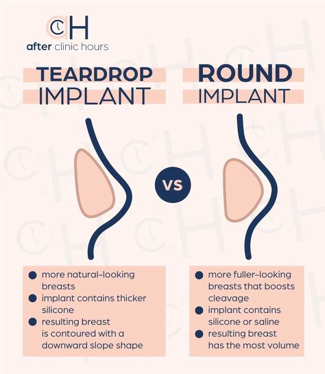 Teardrop Implants, Mastectomy Reconstruction, Mommy Makeover Surgery, Increase Breast Size, Breast Lift Surgery, Pregnancy Women, Aesthetic Surgery, Silicone Implants, Fat Grafting