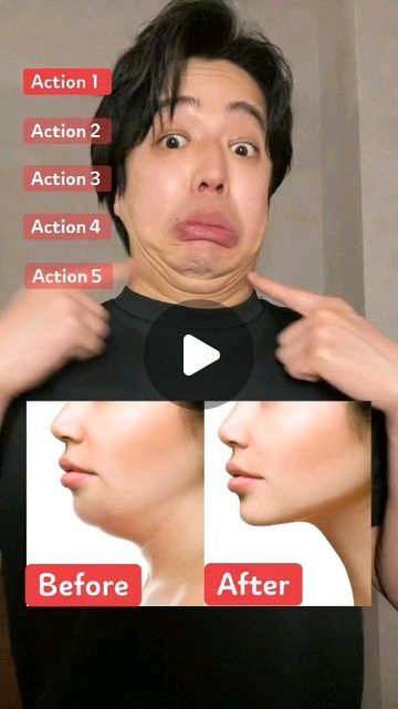 Double Chin Exercises, Chin Exercises, Face Yoga Exercises, Forehead Wrinkles, Facial Exercises, Face Beauty, Face Yoga, Solve Problems, Face Massage