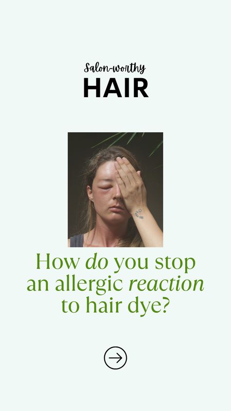 I’ll explain everything you need to know about patch tests and how to do them at home correctly. Hair Dye Allergy, Color Treated Hair Care, New Version Of Yourself, How To Dye Hair At Home, Hair Color Guide, Allergy Testing, Home Remedies For Hair, Color Guide, Scalp Health