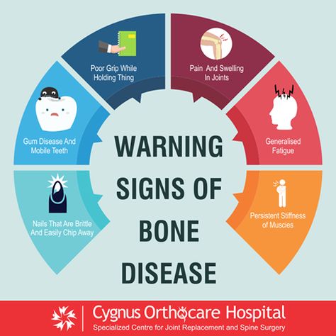 Your #bones are #LivingTissues that rebuild constantly throughout your #life, So prevent bone loss & bone diseases which are caused by poor #nutrition, #genetics, or problems with the rate of bone growth or rebuilding.!! How To Break A Bone, Bone Diseases, Poor Nutrition, Fat Burning Diet, Spine Surgery, Bone Loss, Homeopathic Medicine, How To Get Clients, Nurse Life