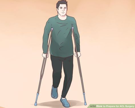 4 Ways to Prepare for ACL Surgery - wikiHow Acl Exercises, Acl Tear Recovery, Acl Surgery Recovery, Meniscus Injury, Surgery Prep, Knee Meniscus, Meniscus Surgery, Acl Rehab, Acl Knee