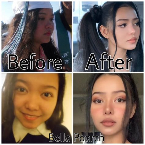 Subliminal Results Hair, Subliminal Results, Kpop Plastic Surgery, Jaw Reduction Surgery, Vacation Hacks, V Line Surgery, Plastic Surgery Fail, Horrible Tattoos, Korean Plastic Surgery