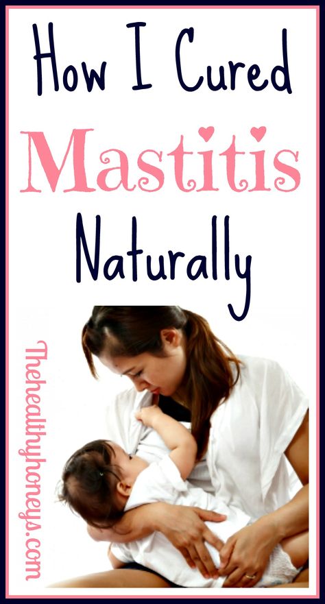 mastitis p Mastitis Remedies, Butter Mochi, Healthy Honey, Natural Pregnancy, Nursing Tips, Natural Parenting, Attachment Parenting, Post Pregnancy, Breastfeeding Tips