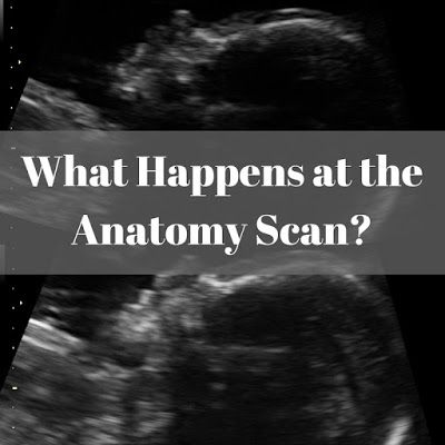 The anatomy scan typically happens between 18 to 21 weeks, but usually, they aim for 20 weeks (which is why you will hear it called the ... Pregnant Ultrasound, 20 Week Scan, 21 Weeks Pregnant, Pregnancy Ultrasound, 20 Weeks Pregnant, Ultrasound Pictures, All About Pregnancy, Pregnancy Information, 20 Weeks