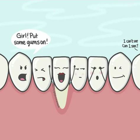 Hehe I love this! Dentist Jokes, Dentistry Humor, Dental Quotes, Dental Posts, Dental Jokes, Dental Hygiene School, Dental Anatomy, Gum Recession, Dental Fun