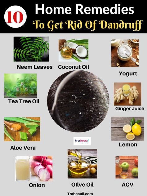 Get Rid Of Dandruff Permanently, Get Rid Of Dandruff Fast, Onion Hair Oil, How To Treat Dandruff, Home Remedies For Dandruff, Onion Hair, Rid Of Dandruff, Fresh Aloe Vera Gel, Dandruff Remedy