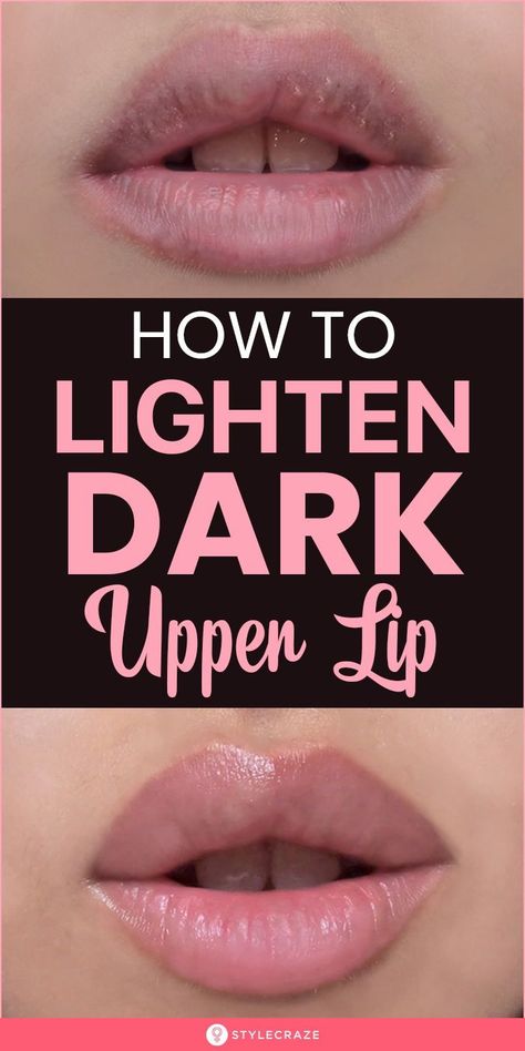 Dark Upper Lip, Remedies For Dark Lips, Lighten Dark Lips, Reduce Hair Growth, Lip Lightening, Lip Care Tips, Upper Lip Hair, Beauty Hacks Lips, Lip Care Routine