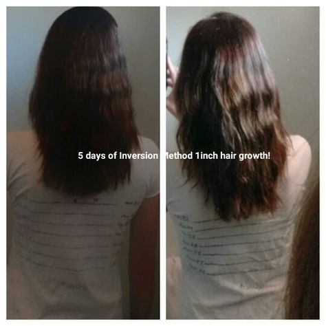 I gave the inversion method ago! Only tried it 5 days and am shocked it actually showed results! Give it ago x Inversion Hair Growth Method, Inversion Method For Hair Growth, Inversion Method, Hair Growth Methods, At Home Face Mask, Prevent Ingrown Hairs, Acne Oil, Tooth Enamel, Skin Care Collection