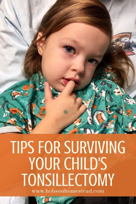 It's hard to know how your child will handle tonsillectomy surgery. So far, I've had two kids with tonsils removed, so here are a few tips I learned along the way that may be helpful for other parents. #tonsillectomy Tonsil Removal Recovery, Kids Surgery, Soft Foods To Eat, Swollen Tonsils, Tonsils And Adenoids, Soft Foods Diet, Recovery Food, Surgery Gift, Soft Foods